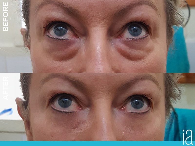 Instantly Ageless Before and After Photos, Ageless Trio Bundle