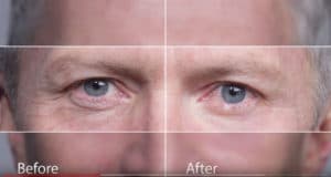 Before and After Instantly Ageless