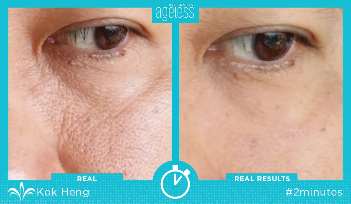 Instantly Ageless Before and After Photos