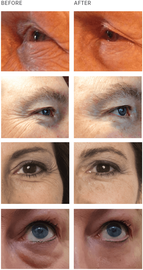 Instantly Ageless Before and After
