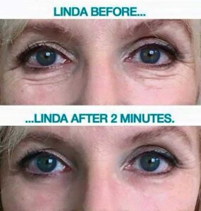 Instantly Ageless Before and After
