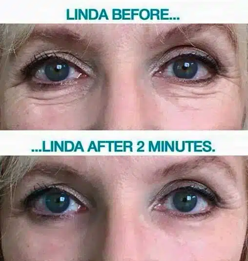 Instantly-Ageless-Before-and-After.jpg.webp