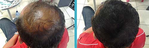 Hair in Seconds Before and After