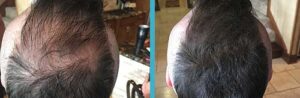 Hair in Seconds Before and After