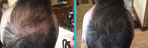 Hair in Seconds Before and After