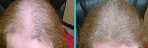 Hair in Seconds Before and After