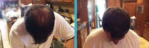 Hair in Seconds Before and After