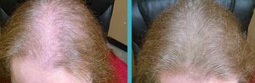 Hair in Seconds Before and After