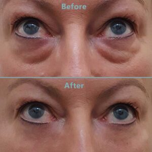 Instantly Ageless Before and After Ageless Canada