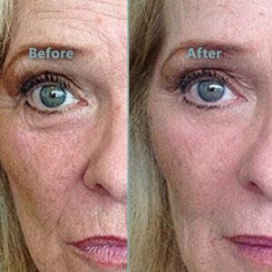 Instantly Ageless Before and After Ageless Canada