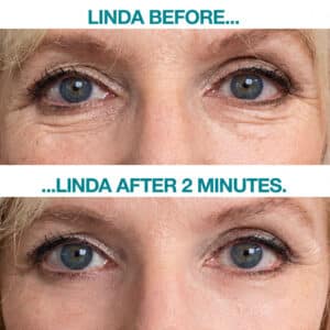 Linda Using Instantly Ageless